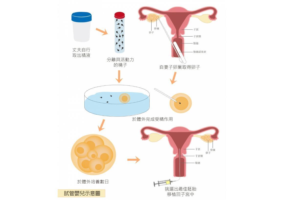 取卵取精后培养多久，探究体外受精过程中的时间因素