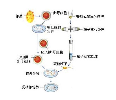 自然周期取卵费用详解，价格、因素与考虑