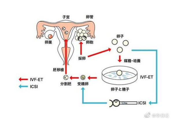 试管取卵过程中雌激素水平超过五千多的影响与应对