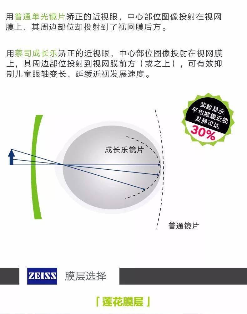 蔡司成长乐镜片真假对比，深度解析与消费者指南