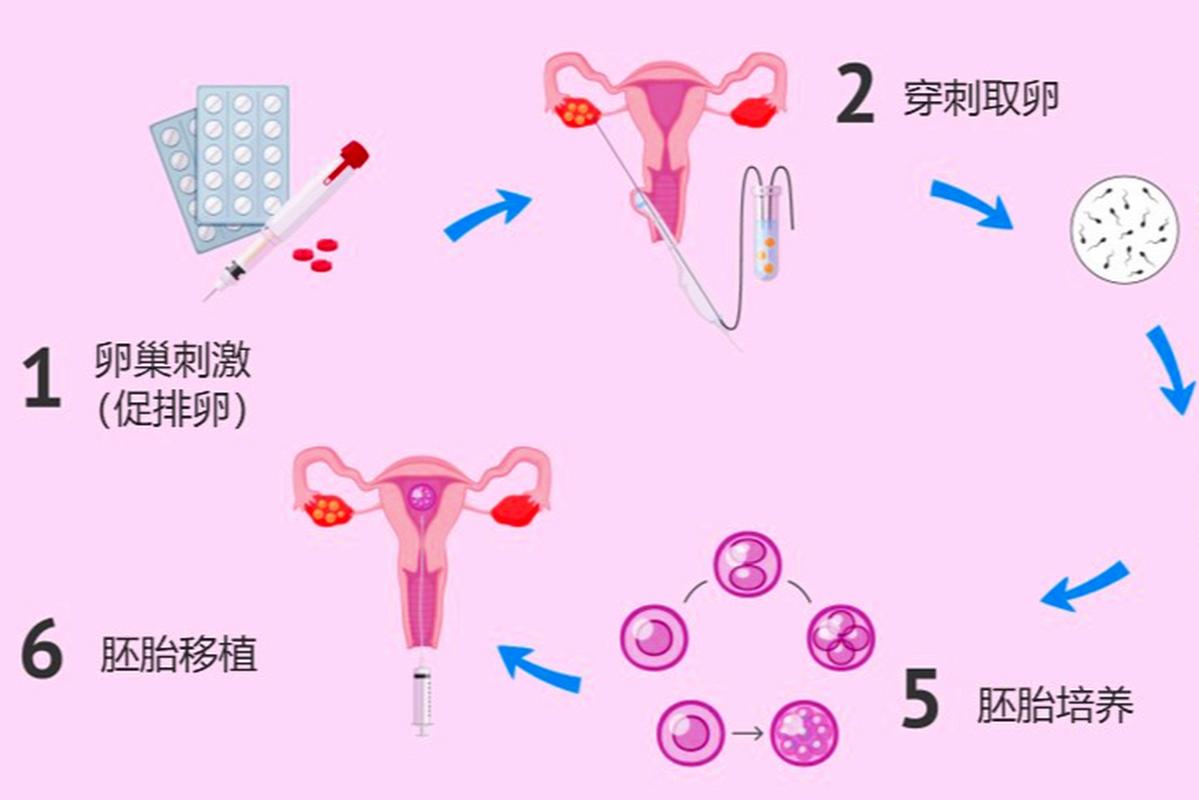 鲜胚移植，取卵后的时间与移植过程详解